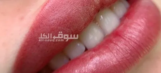 مايكروبليدج - 2